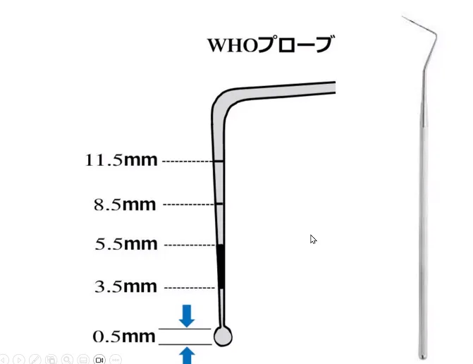 根面う蝕のマネージメント | 宇佐見歯科医院